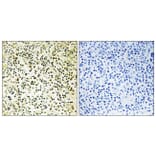 Immunohistochemistry - Anti-NPM Antibody (B1166) - Antibodies.com