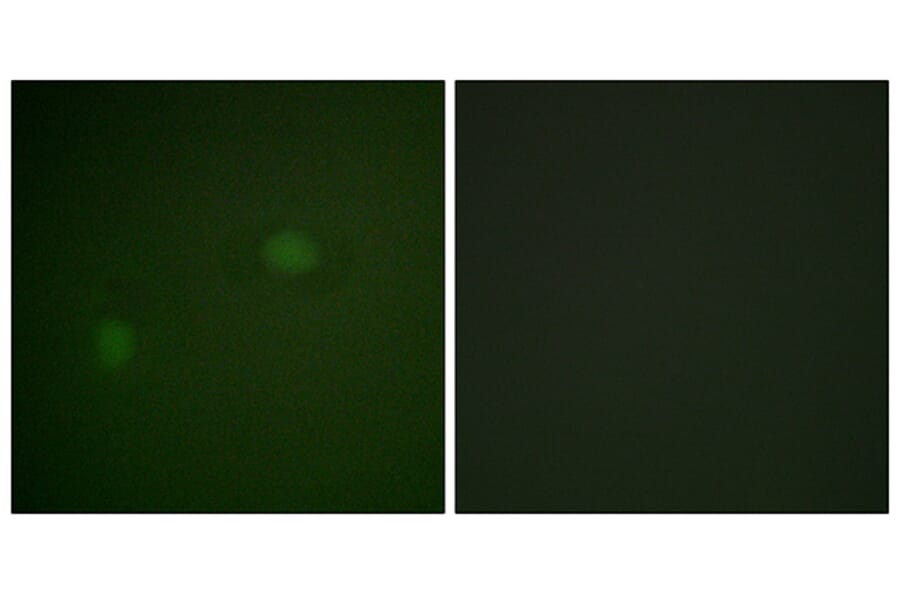 Immunofluorescence - Anti-NPM Antibody (B1166) - Antibodies.com