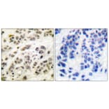 Immunohistochemistry - Anti-MYC Antibody (B0020) - Antibodies.com
