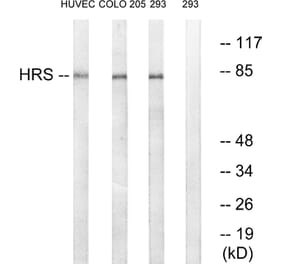 Western Blot - Anti-HRS Antibody (B1044) - Antibodies.com