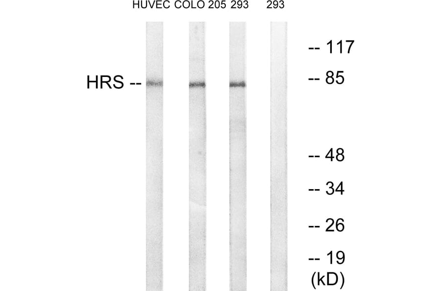 Western Blot - Anti-HRS Antibody (B1044) - Antibodies.com