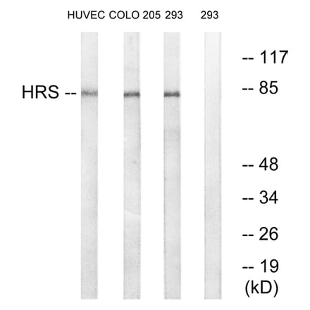 Western Blot - Anti-HRS Antibody (B1044) - Antibodies.com