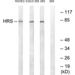 Western Blot - Anti-HRS Antibody (B1044) - Antibodies.com