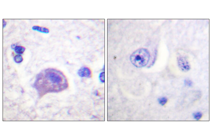Immunohistochemistry - Anti-HRS Antibody (B1044) - Antibodies.com