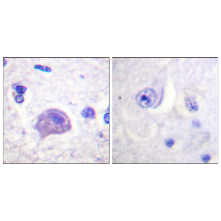 Immunohistochemistry - Anti-HRS Antibody (B1044) - Antibodies.com