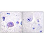 Immunohistochemistry - Anti-HRS Antibody (B1044) - Antibodies.com