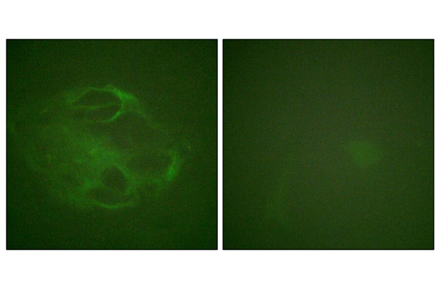Immunofluorescence - Anti-HRS Antibody (B1044) - Antibodies.com