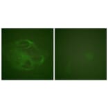 Immunofluorescence - Anti-HRS Antibody (B1044) - Antibodies.com
