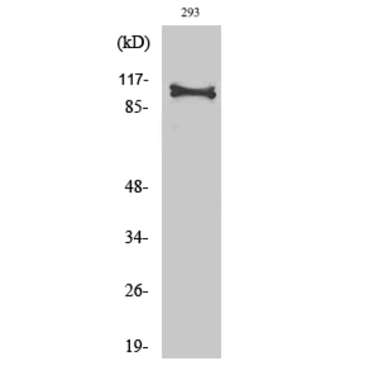 Western Blot - Anti-HRS Antibody (B1044) - Antibodies.com