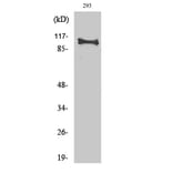 Western Blot - Anti-HRS Antibody (B1044) - Antibodies.com