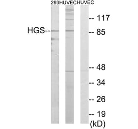 Western Blot - Anti-HGS Antibody (C10062) - Antibodies.com