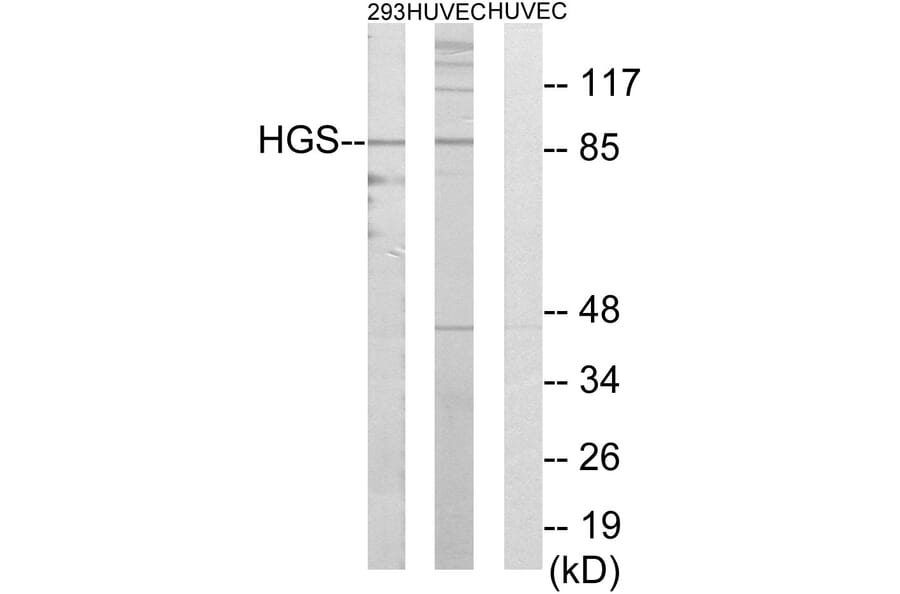 Western Blot - Anti-HGS Antibody (C10062) - Antibodies.com