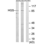 Western Blot - Anti-HGS Antibody (C10062) - Antibodies.com