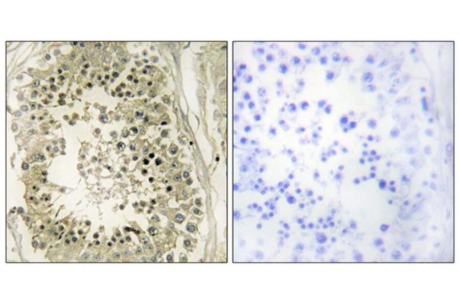 Immunohistochemistry - Anti-HGS Antibody (C10062) - Antibodies.com