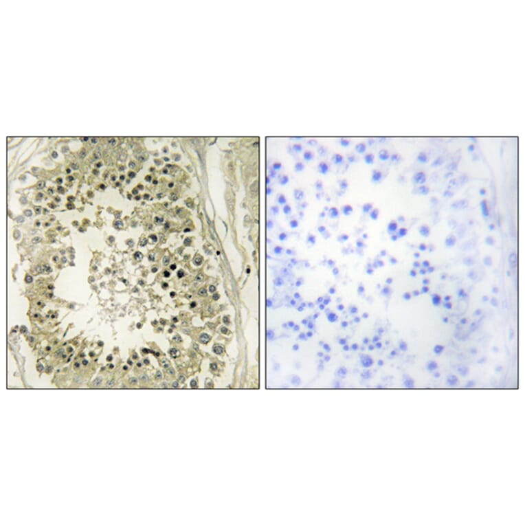 Immunohistochemistry - Anti-HGS Antibody (C10062) - Antibodies.com