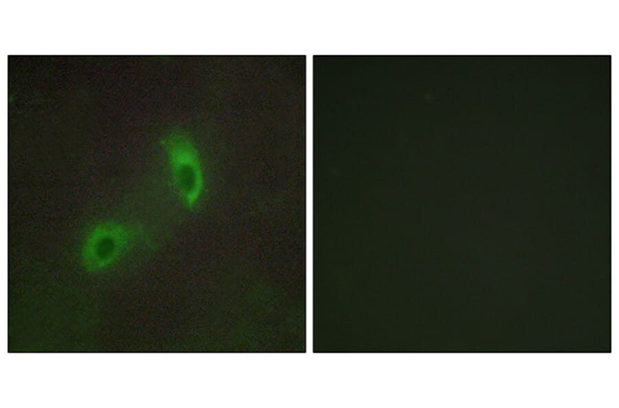 Immunofluorescence - Anti-HGS Antibody (C10062) - Antibodies.com