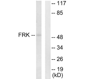 Western Blot - Anti-FRK Antibody (C10609) - Antibodies.com