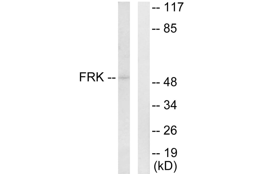 Western Blot - Anti-FRK Antibody (C10609) - Antibodies.com