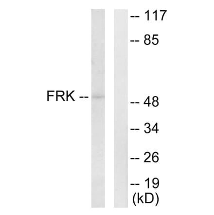 Western Blot - Anti-FRK Antibody (C10609) - Antibodies.com