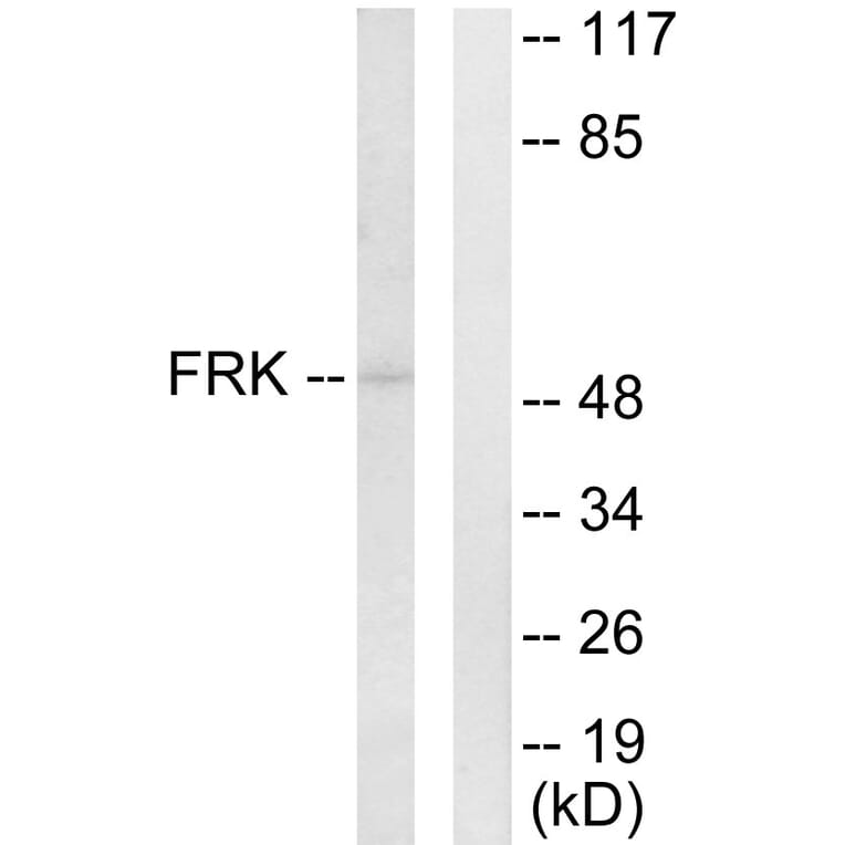 Western Blot - Anti-FRK Antibody (C10609) - Antibodies.com