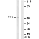 Western Blot - Anti-FRK Antibody (C10609) - Antibodies.com