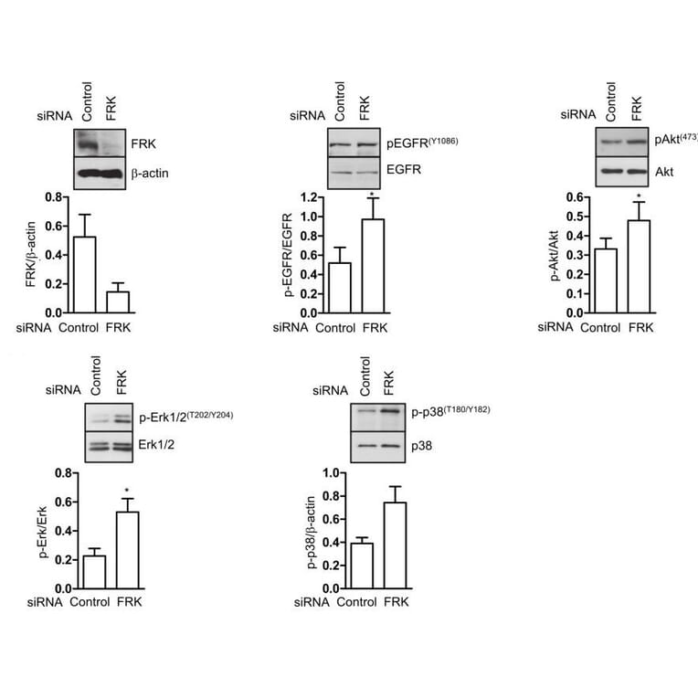 Western Blot - Anti-FRK Antibody - Antibodies.com