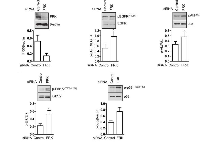 Western Blot - Anti-FRK Antibody - Antibodies.com