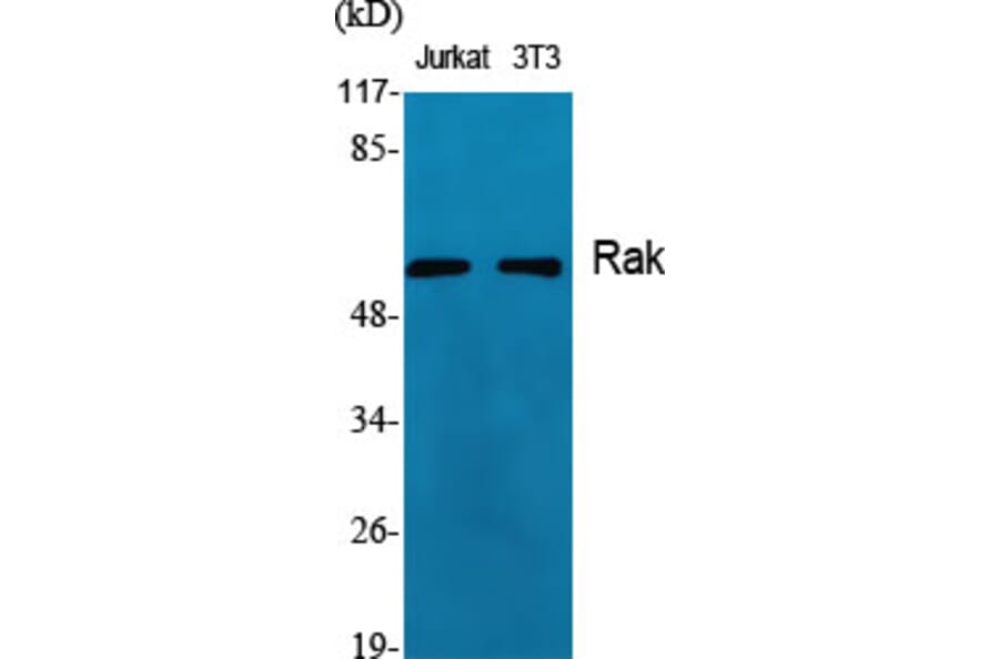 Western Blot - Anti-FRK Antibody (C10609) - Antibodies.com