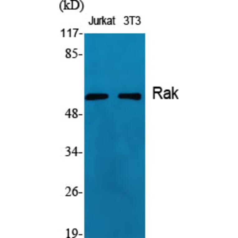 Western Blot - Anti-FRK Antibody (C10609) - Antibodies.com