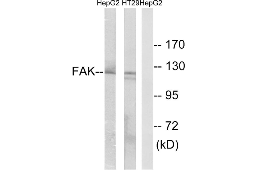 Western Blot - Anti-FAK Antibody (B0925) - Antibodies.com