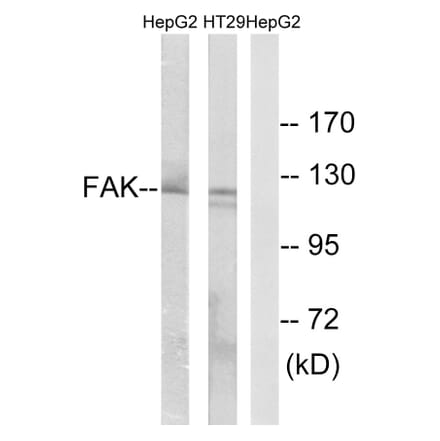 Western Blot - Anti-FAK Antibody (B0925) - Antibodies.com