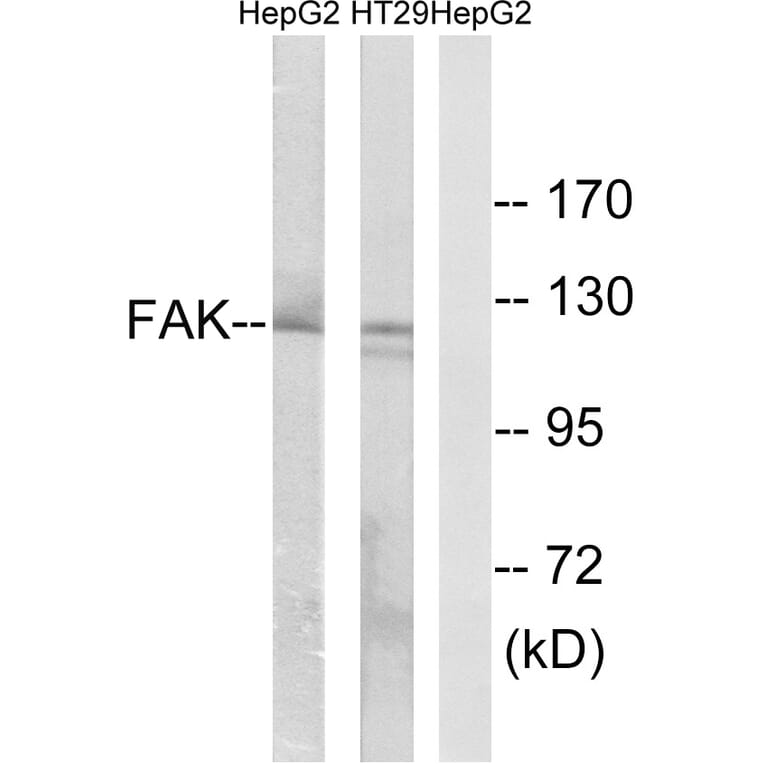Western Blot - Anti-FAK Antibody (B0925) - Antibodies.com