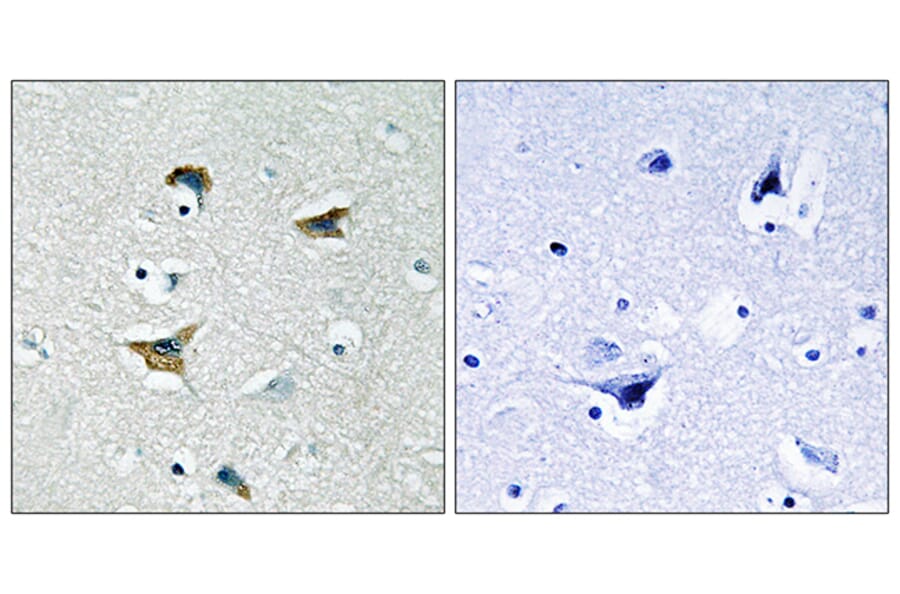 Immunohistochemistry - Anti-FAK Antibody (B0925) - Antibodies.com