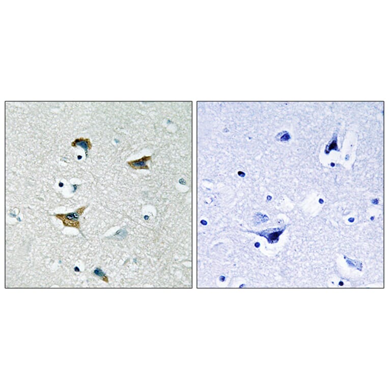 Immunohistochemistry - Anti-FAK Antibody (B0925) - Antibodies.com