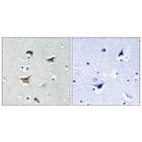 Immunohistochemistry - Anti-FAK Antibody (B0925) - Antibodies.com