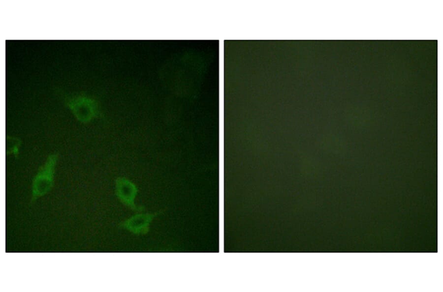 Immunofluorescence - Anti-FAK Antibody (B0925) - Antibodies.com