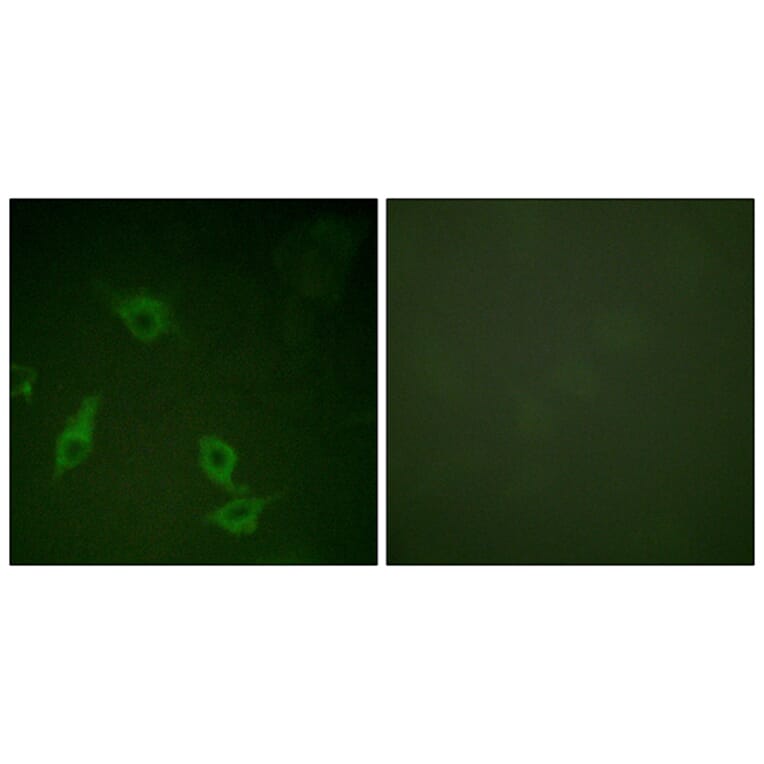 Immunofluorescence - Anti-FAK Antibody (B0925) - Antibodies.com