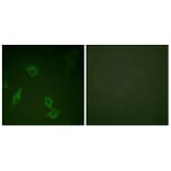Immunofluorescence - Anti-FAK Antibody (B0925) - Antibodies.com