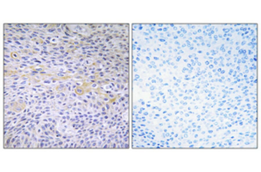 Immunohistochemistry - Anti-FAK Antibody (B0925) - Antibodies.com