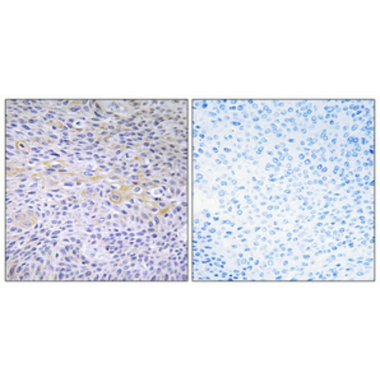Immunohistochemistry - Anti-FAK Antibody (B0925) - Antibodies.com