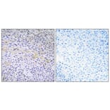 Immunohistochemistry - Anti-FAK Antibody (B0925) - Antibodies.com