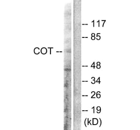 Western Blot - Anti-COT Antibody (B0064) - Antibodies.com