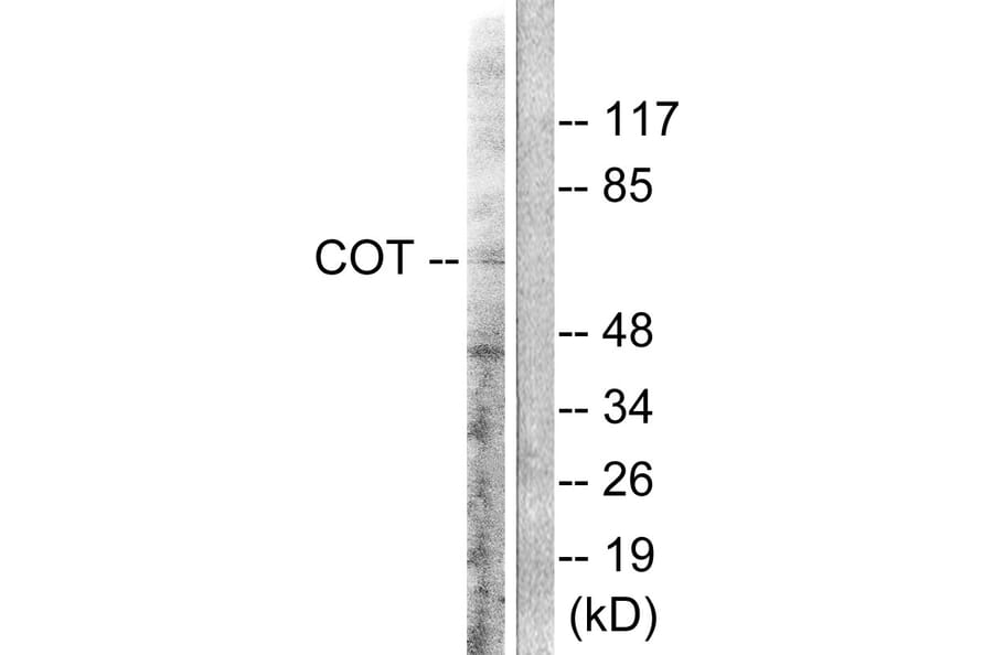 Western Blot - Anti-COT Antibody (B0064) - Antibodies.com