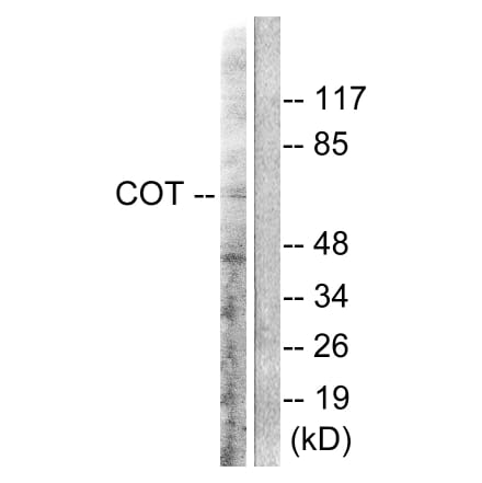 Western Blot - Anti-COT Antibody (B0064) - Antibodies.com