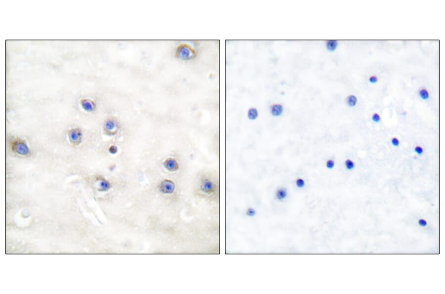 Immunohistochemistry - Anti-COT Antibody (B0064) - Antibodies.com