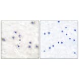 Immunohistochemistry - Anti-COT Antibody (B0064) - Antibodies.com