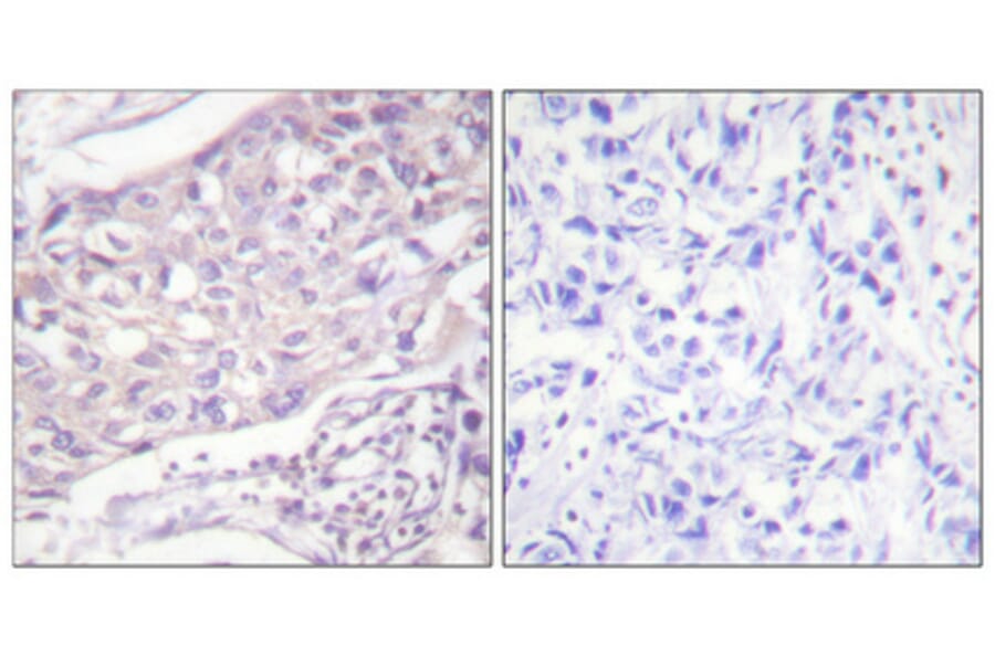 Immunohistochemistry - Anti-COT Antibody (B0064) - Antibodies.com