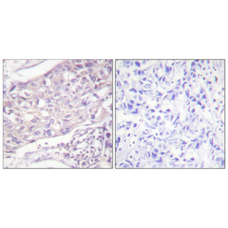 Immunohistochemistry - Anti-COT Antibody (B0064) - Antibodies.com