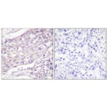 Immunohistochemistry - Anti-COT Antibody (B0064) - Antibodies.com