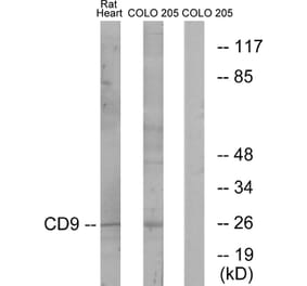 Western Blot - Anti-CD9 Antibody (C12162) - Antibodies.com